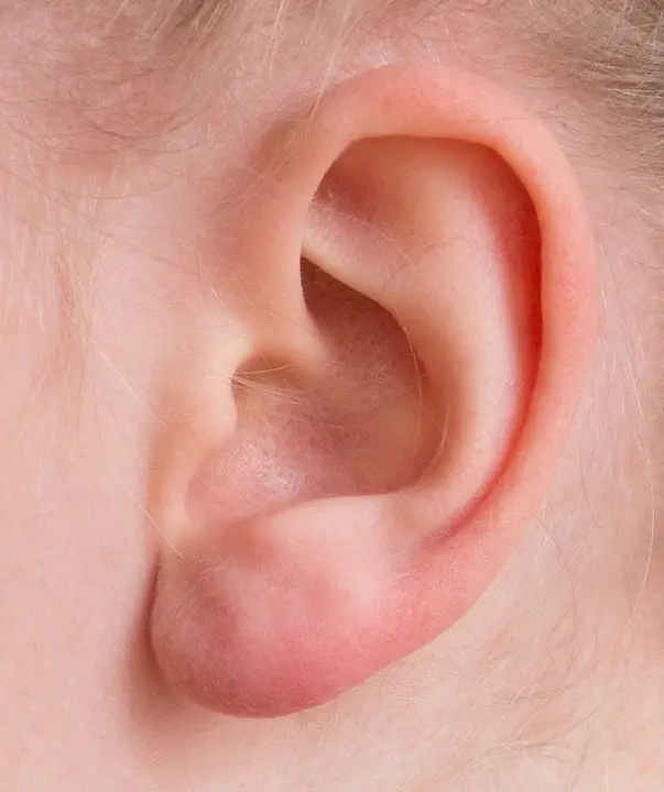 What can you do to prevent ear pain from diving? Showing a detailed ear from the side.